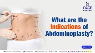 Abdominoplasty Indications  What are the Indications of Abdominoplasty  Abdominoplasty [upl. by Hafler707]