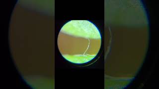 Hidden Wonders of a Terrarium under a Microscope shorts [upl. by Yrred]