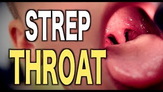 Strep Throat LIVE DIAGNOSIS [upl. by Norga53]