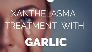 Xanthelasma treatment with garlic does it work [upl. by Heymann290]