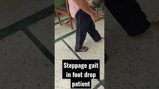 What is Steppage gait in foot drop patient  What is foot drop gait  high steppage gait [upl. by Atla457]