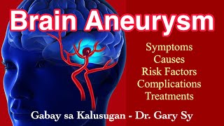 Brain Aneurysm  Dr Gary Sy [upl. by Anilocin104]