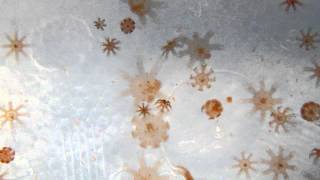 Moon Jellies at the Ephyra stage feeding Brine Shrimp [upl. by Rebba676]