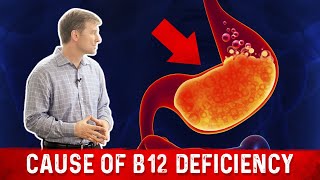 Vitamin B12 Deficiency The most common Cause – Dr Berg [upl. by Eixor]