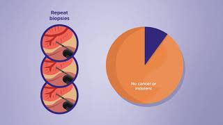 The ConfirmMDx for Prostate Cancer test [upl. by Nilrah]