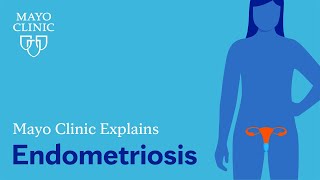 Mayo Clinic Explains Endometriosis [upl. by Hills]