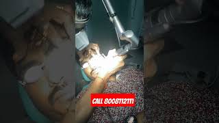 Laser removal of the Nevus of ota 4th sitting at cosmos vizag Dr gopal krishna MD doctor [upl. by Trilbie262]