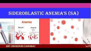 Lecture 17 Sideroblastic Anemia  SA [upl. by Georgetta63]