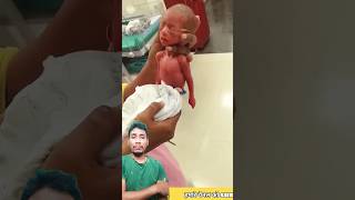 5 month premature delivery amazing newbornbaby baby nicu babydocter prematurebaby [upl. by Jillene]