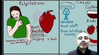 Palpitations vs Arrhythmias What is the most common cause of palpitations [upl. by Elton]