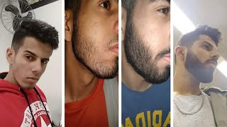 COMO FIZ A MINHA BARBA CRESCER do NADA EVOLUÇÃO MINOXIDIL ANTESDEPOIS DICAS e SEGREDOS [upl. by Therese]