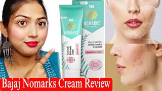 Bajaj Nomarks Cream Review  Remove Acne Scars Dark Spots Blemish  For Normal Skin [upl. by Esiocnarf]