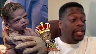 Shuler King  This Baby Is Upset About Something [upl. by Medina681]