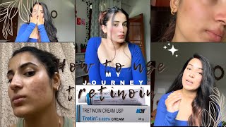 How to use tretinoin 0025 my journeyE2 tretinoin tretinoincream myjourney acnetreatment [upl. by Lynus]