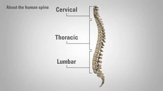 Radiculopathy  Patient Education [upl. by Alegnasor931]