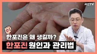 한포진 증상 원인부터 관리법까지 체질 음식 보습제  한의사 서산 [upl. by Oiril837]