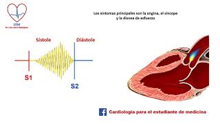 Auscultación de la estenosis valvular aórtica [upl. by Felipa71]