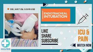 How to Perform Endotracheal Intubation A Clinical Demonstration [upl. by Noid]