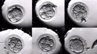 IVF PROCESS STEP BY STEP In Vitro Fertilisation Embryo cultivation [upl. by Arihsay]