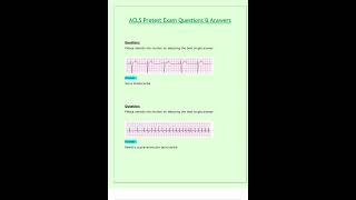 ACLS Pretest Exam Questions amp Answers Latest 2024 2025 [upl. by Ahselyt80]