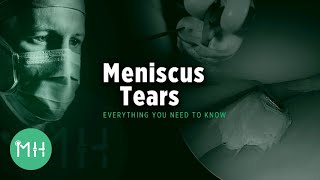 Meniscus Tears  Everything you need to know [upl. by Leopoldine309]