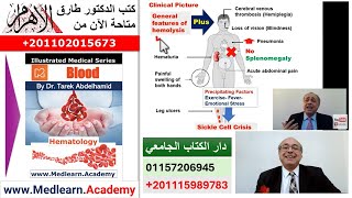 Sickle Cell Anemia cme internalmedicine medical medicalstudent usmle محاضراتباطنة [upl. by Ahar437]