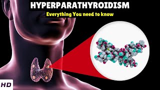 Hyperparathyroidism – Types Causes Signs and Symptoms Diagnosis amp Treatment [upl. by Chaing]