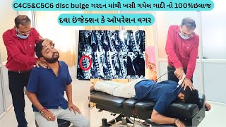 વડોદરા ના અર્પણભાઇ ને 2 વર્ષ નો ગરદન નો દુખાવો થયો સારો દવા કે ઑપરેશન વગરC4C5amp C5C6disc Bulge [upl. by Orgel]