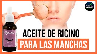 ✅🔴Cómo Utilizar El Aceite De Ricino Para Limpiar Las Manchas De La Cara [upl. by Ontina]