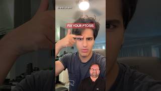 Fix Your PTOSIS Droopy Eyelid Surgeon Reacts [upl. by Naimad]