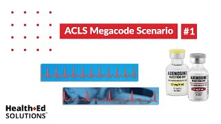 ACLS Megacode Scenario 1 Supraventricular Tachycardia SVT [upl. by Boyer435]