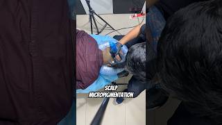 Scalp micropigmentation unlock your confidence scalpmicropigmentation smp [upl. by Sansbury]