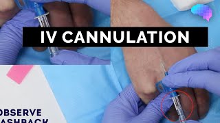 Intravenous IV cannulation  OSCE Guide  UKMLA  CPSA [upl. by Aihselat79]