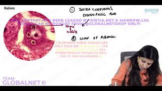 CNS  NON NEOPLASTIC LESIONS By Dr Illa jain khandelwal Pathology by Marrow Video Lecture [upl. by Nekial728]