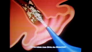 Murine Ear Wax Removal System commercial Family Channel March 10 1992 [upl. by Kubiak]