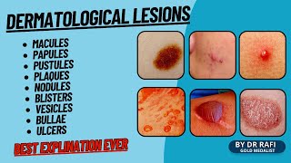 Dermatology Lesions Terminology Nomenclature of Primary Skin Lesions [upl. by Guria]