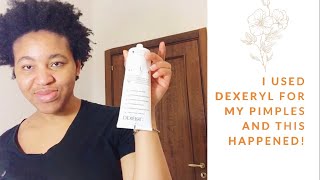 Can Dexeryl combat acne or pimple Yes or No [upl. by Yenffit]