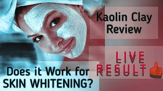 Magical Face Mask Kaolin Clay Review [upl. by Nirrek990]