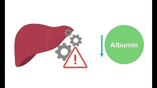 Getting to know albumin physiology [upl. by Jauch738]