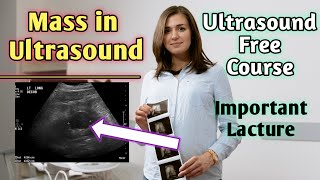 Can masses be seen on ultrasound  Does hypoechoic mass mean cancer [upl. by Alphonsine]