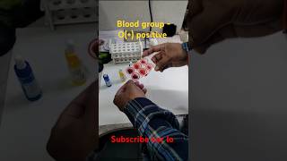 ABO Rh test kaise kiya jata hai  Blood group test kaise kare  medicalstudent laboratory [upl. by Amando128]