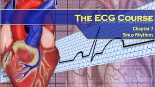 The ECG Course  Sinus Rhythms [upl. by Pena]