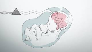 What is hypoxic ischemic encephalopathy [upl. by Enenaj884]