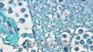 Naegleria fowleri What You Need to Know [upl. by Eceertal]