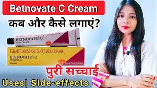 Betamethasone and clioquinol cream bp betnovate c skin cream  BetnovateC Cream Honest Review [upl. by Elime582]