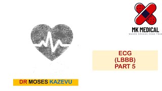 ECG LBBB Part 5 [upl. by Naivad744]