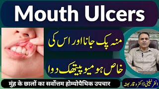 Mouth Ulcers منہ پک جانا मुँह के छाले Homeopathic Treatment in Urdu  Hindi [upl. by Sherie]