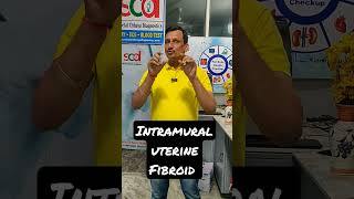 What Are Intramural Fibroids ajaykaushik sheetalchhaya lab bestdignosticcentre health [upl. by Leal]