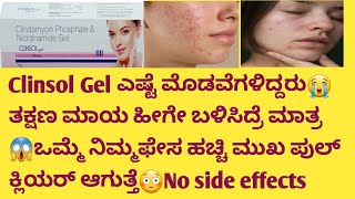 Clinsol Gel👌😍ಎಷ್ಟೆ ಮೊಡವೆಗಳಿದ್ದರು😭 ತಕ್ಷಣ ಮಾಯ😱ಒಮ್ಮೆ ನಿಮ್ಮಫೇಸ ಹಚ್ಚಿ ಮುಖ ಪುಲ್ ಕ್ಲಿಯರ್ ಆಗುತ್ತೆ😳 [upl. by Etti892]