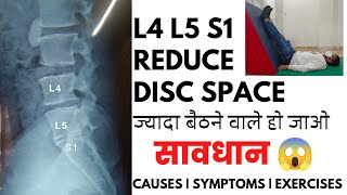 L4L5 and L5S1 reduced disc space exercises in Hindi  Disc space narrowing L5S1 treatment [upl. by Fabron207]